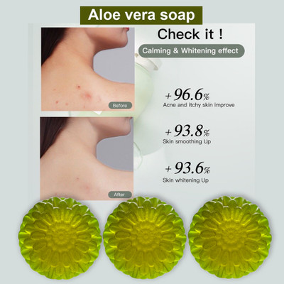 Groovy Aloe Vera Soap for Sensitive Skin (100GM) (PACK OF 3)(3 x 100 g)