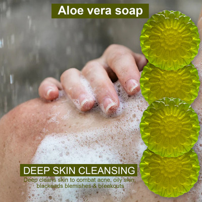CHITAKSH Aloe Vera Soap with Natural Ingredients for Safe Use (100GM) (PACK OF 4)(400 g)