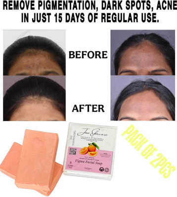 URSUS PROFESSIONAL Jiore Vigwa Facial Soap FOR PIGMENTATION,DARKSPOT, ACNE.INSTANT GLOWING 2PCS,c0(2 x 100 g)
