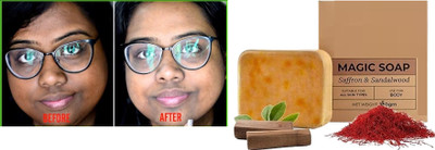 sheny soft kesar bath hand made soap tan removal soap(150 g)