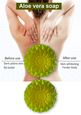 Groovy Cool Aloe Vera Handmade Soap, Acne Control, Scar Reduction & Body Odor Control(2 x 50 g)