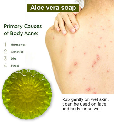 TERIHAR Aloe Vera Soap with Patchouli for an Earthy Scent(100 g)