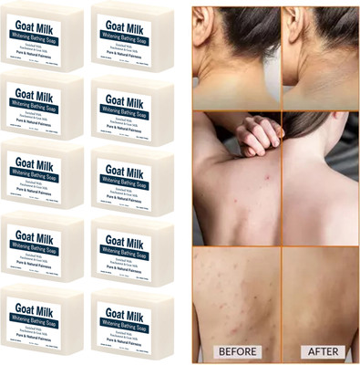 ONEAL Goat Milk Hand Made Deep Cleansing Bath Soap For Skin Whitening (10 Pcs)(10 x 100 g)