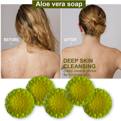 Groovy Aloe Vera Clean Bathing Soap (100GM) (PACK OF 5)(5 x 100 g)