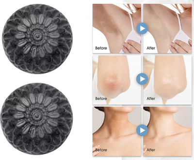 CHITAKSH Say goodbye to blemishes with activated charcoal soap(2 x 100 g)