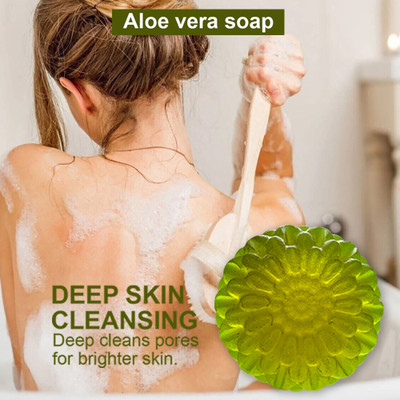 CHITAKSH Nourishing Aloe Vera Soap for a Healthy Glow(100 g)