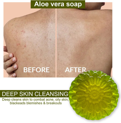 TERIHAR Refreshing Aloe Vera Soap for a Healthy Glow and Soft Skin(100 g)