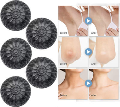 CHITAKSH Clear acne and impurities with our charcoal soap(5 x 100 g)