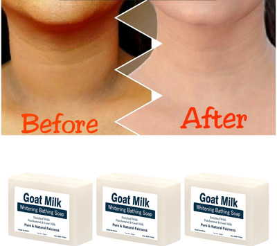 Velocius Enterprise Goat Milk Whitening Soap with Kojic Acid and Shea Butter(3 x 100 g)
