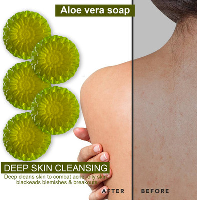 CHITAKSH Aloe Vera Replenishing Bathing Soap (100GM) (PACK OF 5)(500 g)