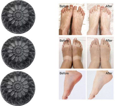 CHITAKSH Activated charcoal soap for a natural, healthy complexion(3 x 100 g)
