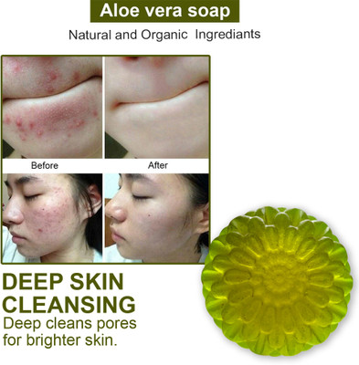 CHITAKSH Invigorating Aloe Vera Soap with Peppermint for a Refreshing Bathing Experience(100 g)