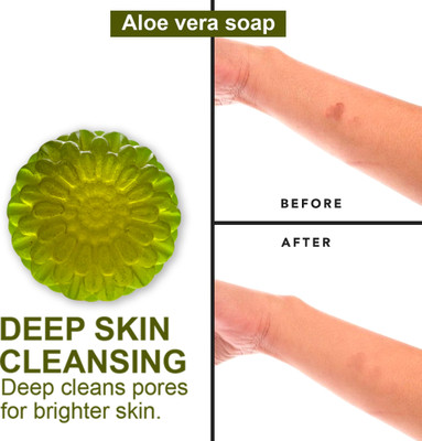 CHITAKSH Aloe Vera Soap for Acne-Prone Skin(100 g)