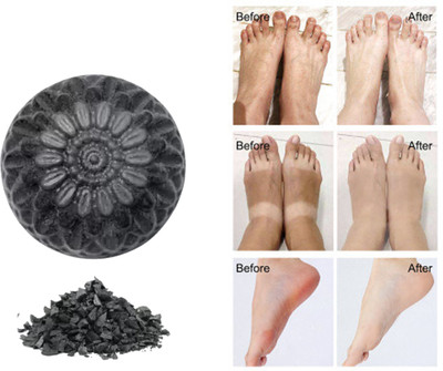 CHITAKSH Experience the magic of activated charcoal soap for yourself(100 g)