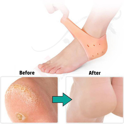LOOKFIT Heel Socks Silicone heel protector pain relief Gel Heel anti-Crack Heel (Beige) Heel Support(Multicolor)