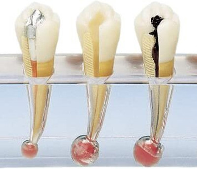 NMD DENTAL TOOL 5 Stage Endodontic Demonstration & Educational Model (Pack Of 1Pcs) Surgical Plier(Plastic)