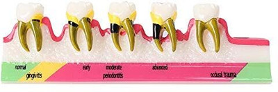 NMD DENTAL TOOL Perio Educational Model (Pack of 1) Surgical Plier(Plastic)