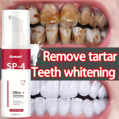 Sonavi Teeth Whitening Foam to Fight Germs Cavity with Mint Extract Teeth Whitening Kit