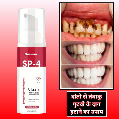 Sonavi Teeth Whitening Foam | Regular Use with Refreshing Flavour | Deep Teeth Cleaning Teeth Whitening Kit