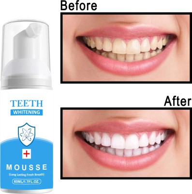 REGLET removes stains Whitening bright Teeth Whitening Liquid Toothpaste Teeth Whitening Kit