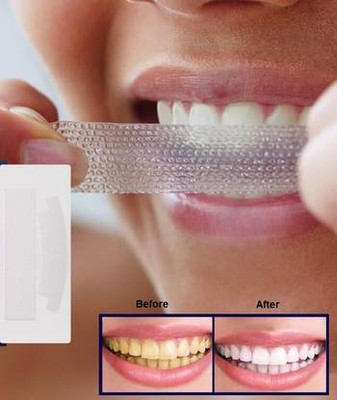 JINCHA Portable Advanced Professional Teeth Whitening Strips Teeth Whitening liquid Teeth Whitening Kit