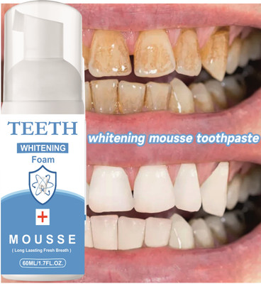Sandarbh Deeply Clean Gums and Cavity Protection Teeth Whitening Foam Teeth Whitening Kit