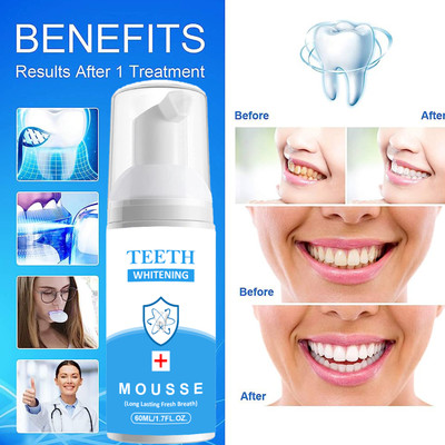 Latibule Teeth Whitening Foam Kit to Ultra-fine Deeply Clean Gums Intensive Stain Removal Teeth Whitening Kit