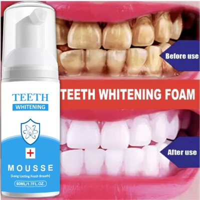 Qwera Dream White -Fresh Mint Instant Mouthwash Teeth Whitening Foam - Mint(60 ml)