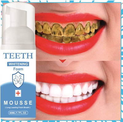 Sandarbh Teeth Whitening foam Make your Teeth Sparkle And White Teeth Whitening Teeth Whitening Kit