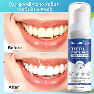 smartdrops Anti-Cavity & Sensitive Relief Toothpaste | Deep Cleansing & Stain Removal Teeth Whitening Kit