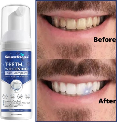 smartdrops Teeth Whitening Foam to Ultra-fine Deeply Clean Gums & Cold freshness Effect Teeth Whitening Kit