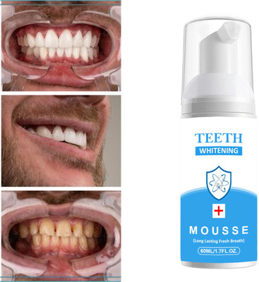 REGLET HELP CAVITIES AND SENSITIVITY,FIGTS GERMS AND BAD BREATH Teeth Whitening Kit