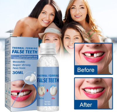 Qorelya Tooth Repair and Replacement Kit Quick Temporary Fix Easy to Use Teeth Whitening liquid(30 ml)