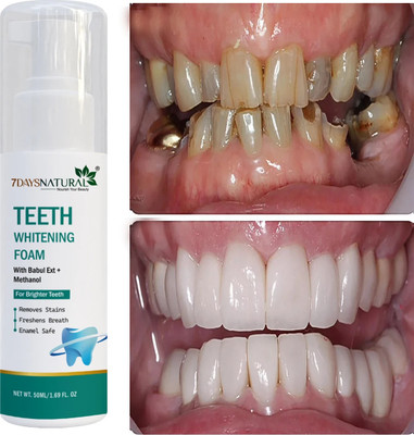 7 Days Teeth Whitening Foam to Ultra-fine YELLOW TEETH Deeply Intensive Stain Removal Teeth Whitening liquid(50 ml)