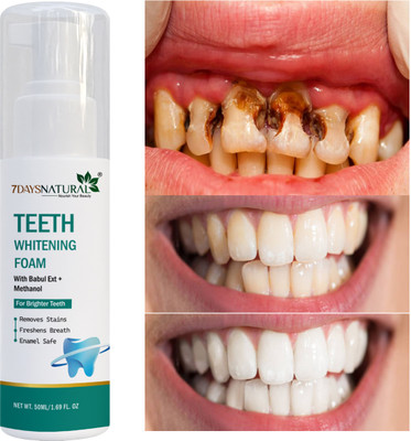 7 Days foam Make your Sparkle Teeth Whitening liquid(50 ml)