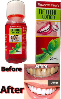 dll 20ML Teeth Whitening liquid(20 ml)