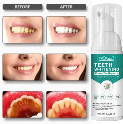 Phillauri Teeth Whitening Foam To Removes Bad Breath and Fights Germs Teeth Whitening liquid(60 ml)