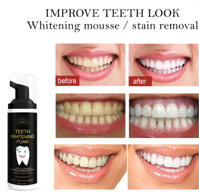 Desi Crew Activated Charcoal Instant Teeth Whitening Foam Yellow Teeth Removal Teeth Whitening liquid(60 ml)