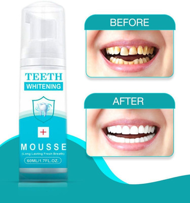 NEPROENT Teeth Whitening pack of 1 Teeth Whitening liquid(60 ml)