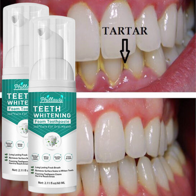 Phillauri Teeth Brightens Foam to Fightt Germs Cavity with Mint Extract Teeth Whitening liquid(120 ml)