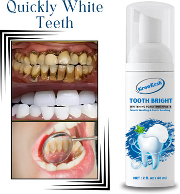 Growkesh Teeth Cleansing Foam Deeply Cleans & Fights Bad Breath Teeth Whitening liquid(60 ml)