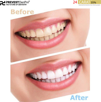 Prevest Denpro 24 Carat Advanced Zero Sensitivity Tooth Whitening System Teeth Whitening liquid(5 ml)