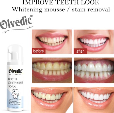 Olvedic Teeth Whitening Foam To Remove Yellow Stains, Tobacoo, Tartar and Tobacco Stains Teeth Whitening liquid(60 ml)