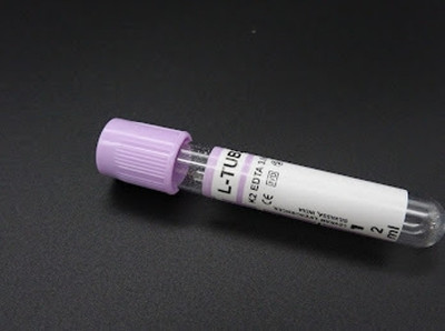 LEVRAM 4 ml Rimmed Polyethylene Test Tube(7.5 cm 230 K Pack of 100)