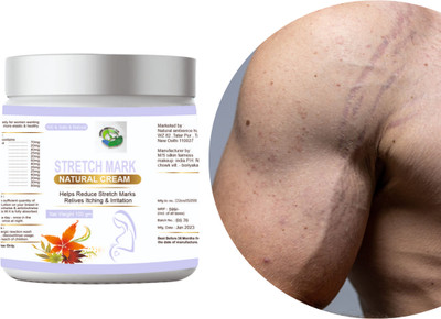 Natural ambience hub STRCH MARK REMOVAL CREAM FOR REMOVE STRECH MARK Men & Women(100 g)