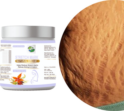 Natural ambience hub Stretch marks cream For Women, stretch marks cream During Pregnancy cream Men & Women(100 g)