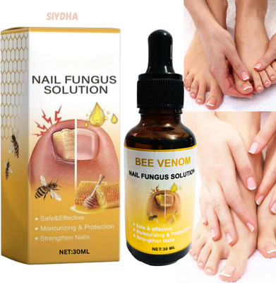 SIYDHA Nail Fungal Solution Serum – Boost Growth And Health Men & Women(30 ml)