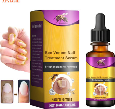 AYYIASHI Bee Venom Nail Fungus Solution Clears Infection And Strengthens Nails Men & Women(30 ml)