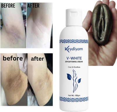 keydiyam V-White CreamArea Whitening Cream skin cream for private areas blackness Women(100 ml)
