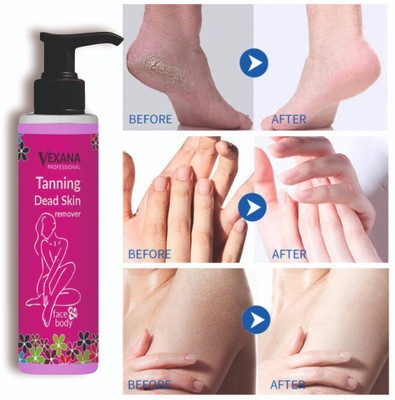 vexana Beauty Tanning Dead Skin Remover Men & Women(100 ml)
